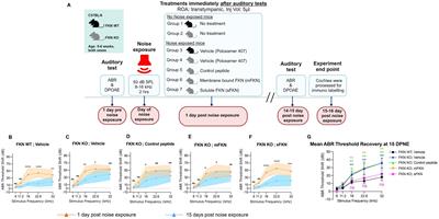 Local delivery of soluble fractalkine (CX3CL1) peptide restores ribbon synapses after noise-induced cochlear synaptopathy